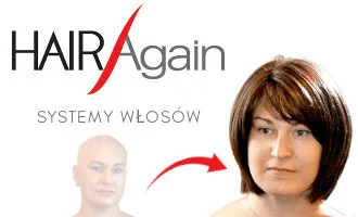 Hair replacement systems Hair replacement systems